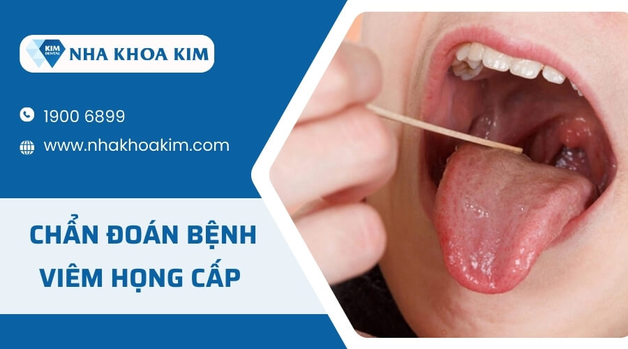 Phương pháp chẩn đoán bệnh viêm họng cấp