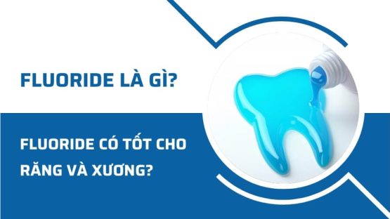 Fluoride là gì? Fluoride có tốt cho răng và xương không?