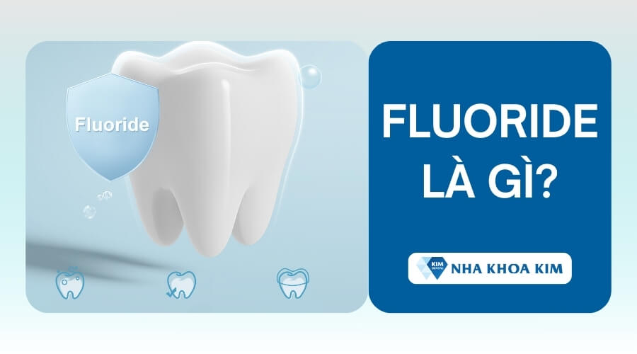 Fluoride là gì?