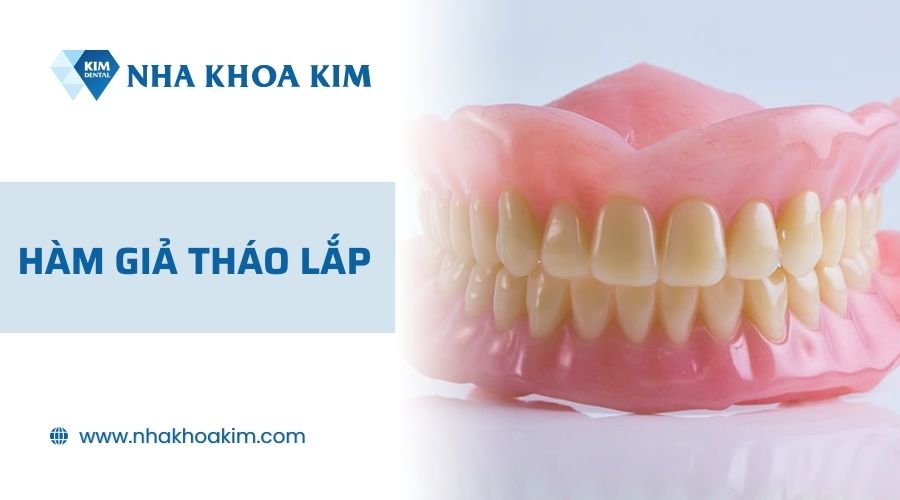 Phục hình răng mất bằng hàm tháo lắp