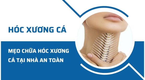 Mẹo chữa hóc xương cá ở cổ họng tại nhà an toàn