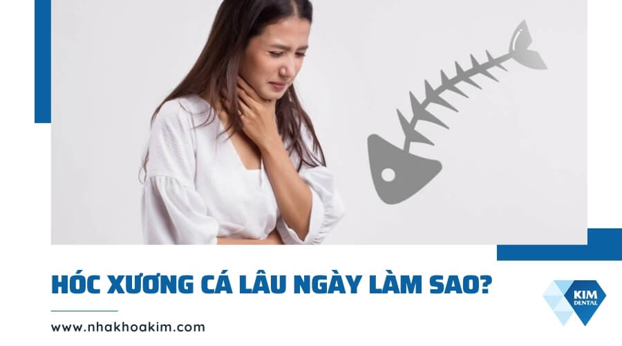 Hóc xương cá trong họng lâu ngày phải làm sao?