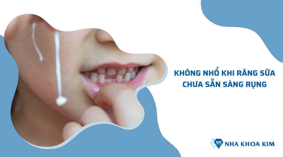 Không nhổ khi răng sữa chưa sẵn sàng rụng