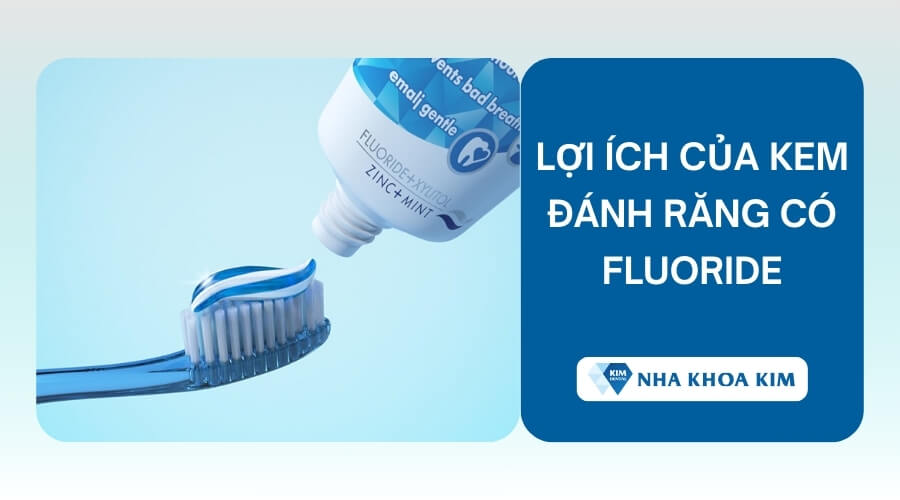 Lợi ích của kem đánh răng có Fluoride