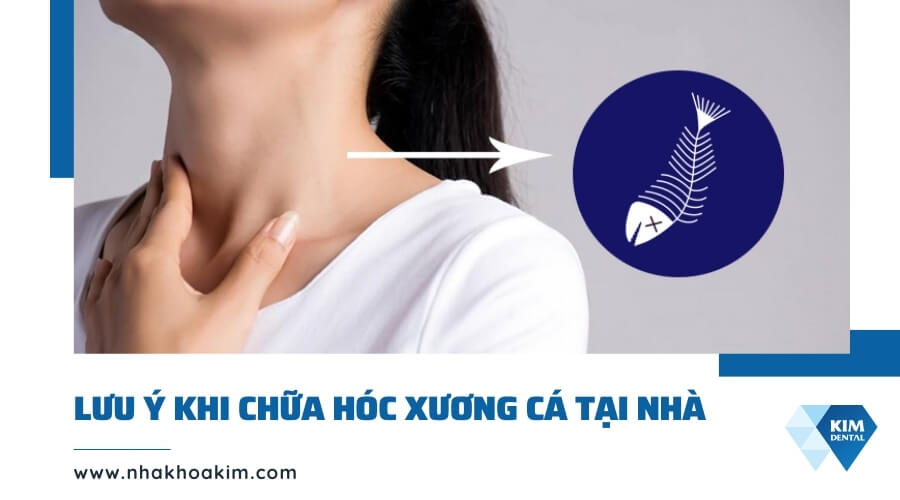 Lưu ý khi chữa hóc xương cá tại nhà