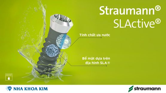 Không chỉ là phục hình răng, chất lượng cuộc sống được cải thiện với Implant Straumann SLActive®