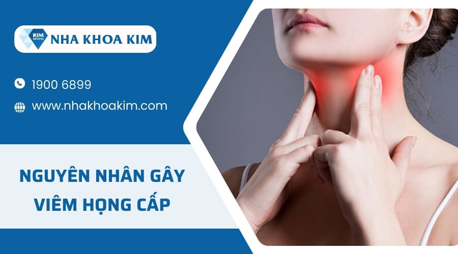 Nguyên nhân gây viêm họng cấp