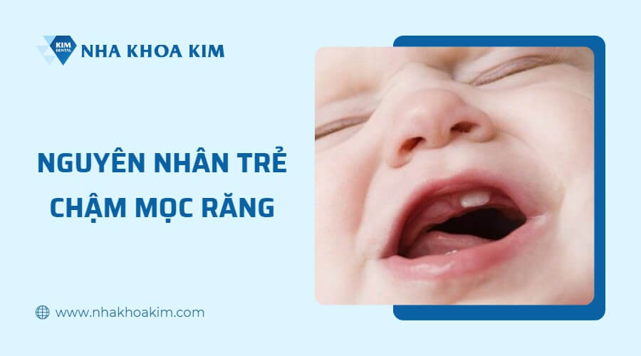 Nguyên nhân trẻ chậm mọc răng