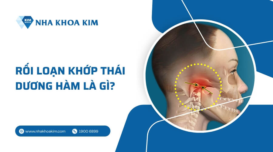 Rối loạn khớp thái dương hàm là gì?