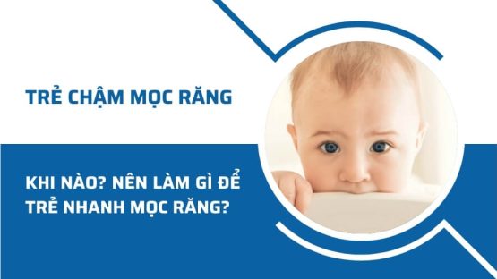 Trẻ chậm mọc răng khi nào? Làm gì để trẻ nhanh mọc răng