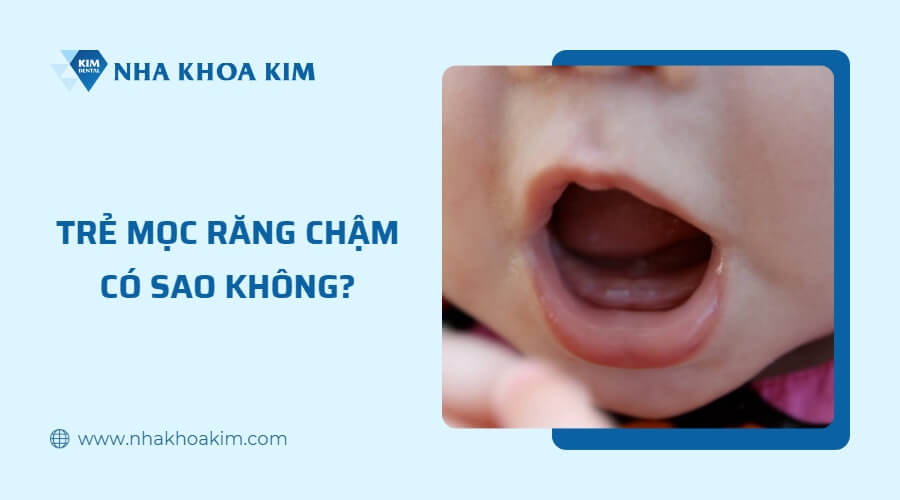 Trẻ mọc răng chậm có sao không?