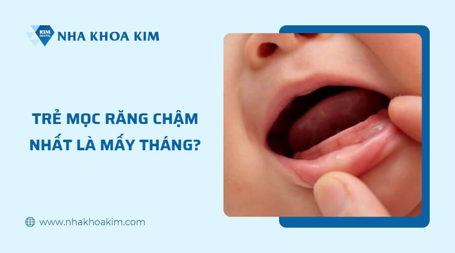 Trẻ mọc răng chậm nhất là mấy tháng?