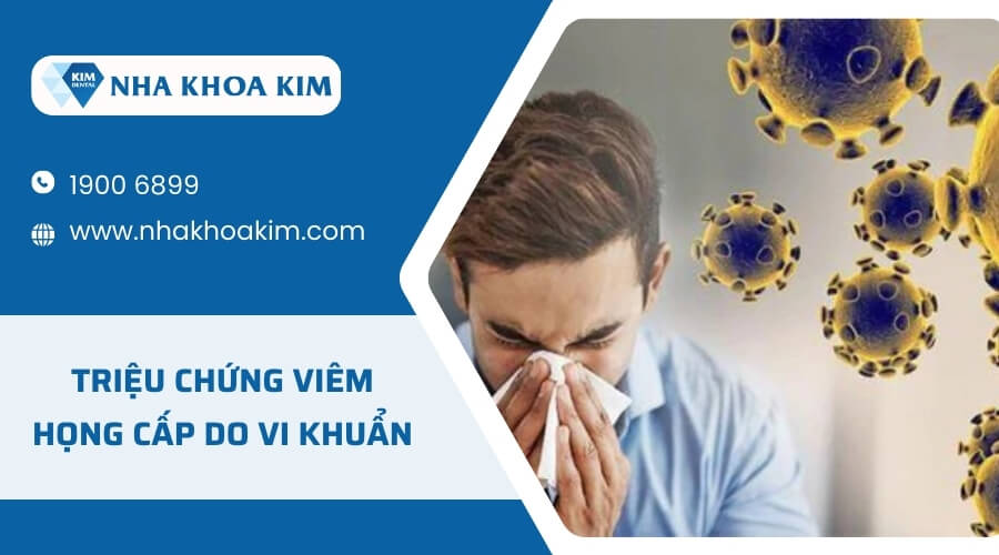 Triệu chứng của viêm họng cấp do nhiễm khuẩn