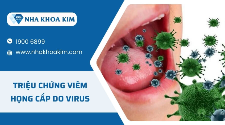 Triệu chứng của viêm họng cấp do nhiễm virus