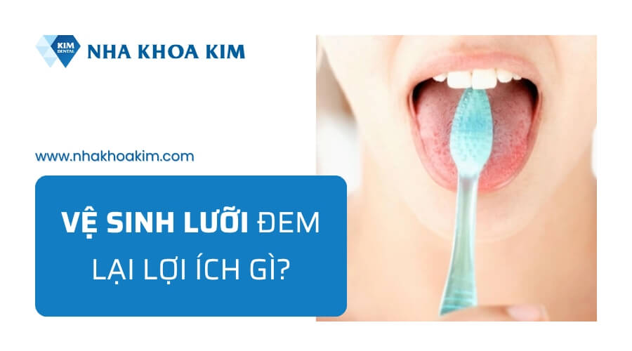 Có cần vệ sinh lưỡi không?