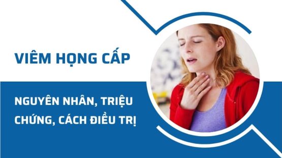 Viêm họng cấp: Nguyên nhân, triệu chứng và cách điều trị