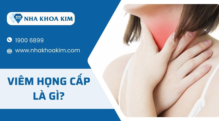 Viêm họng cấp là gì?