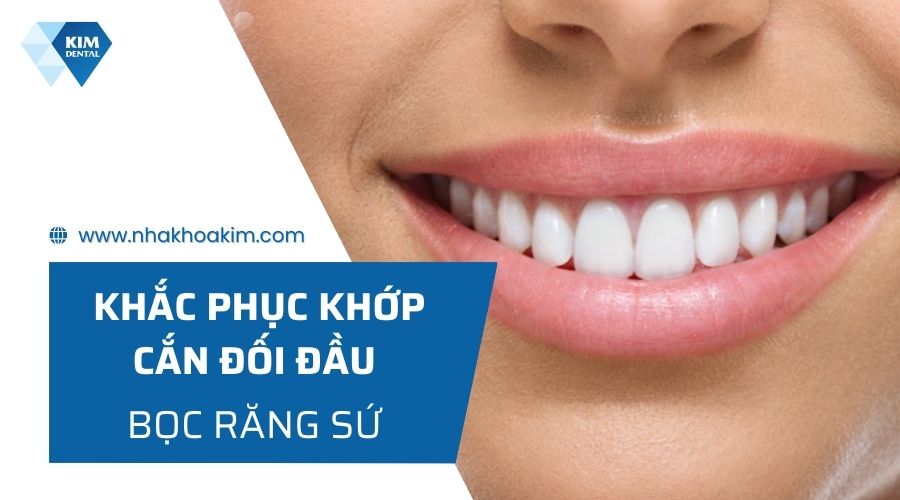 Bọc răng sứ cải thiện tình trạng khớp cắn đối đầu