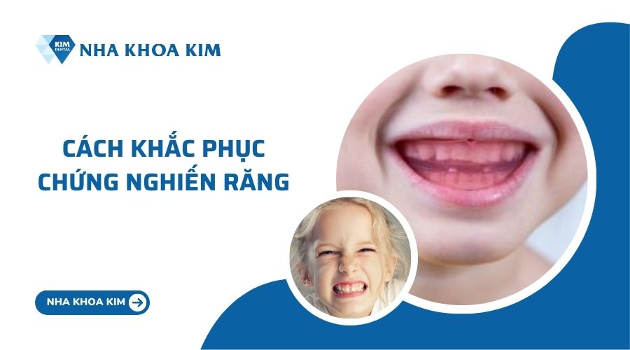 Cách khắc phục tình trạng nghiến răng ở trẻ