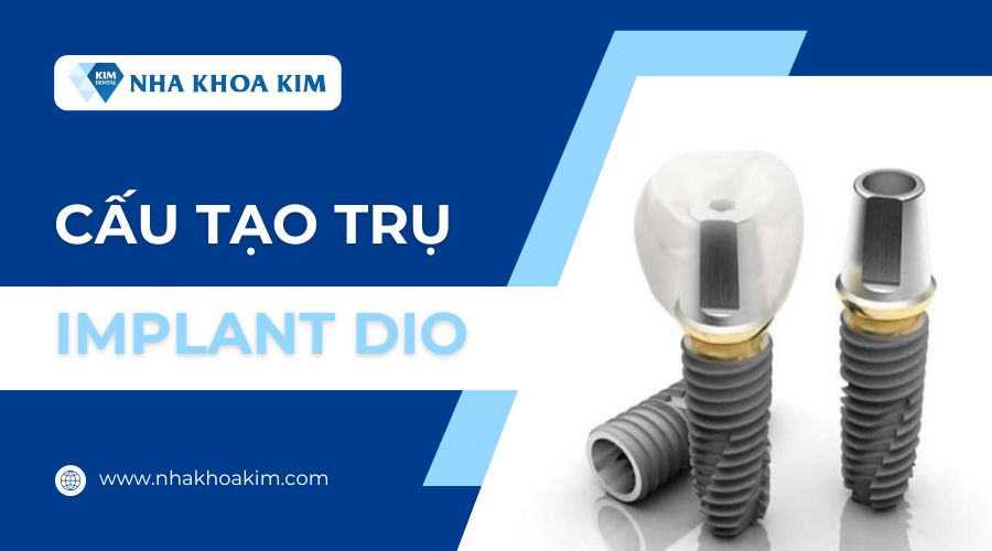 Cấu tạo trụ Implant Dio