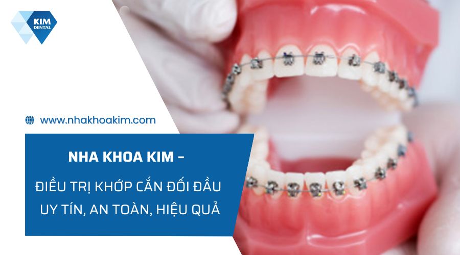 Địa chỉ điều trị khớp cắn đối đầu an toàn, hiệu quả