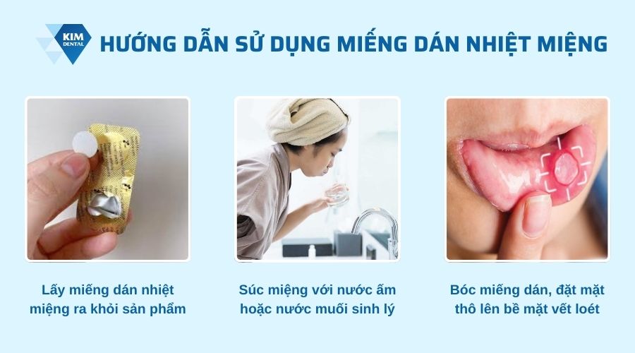 Cách sử dụng miếng dán nhiệt miệng đúng cách