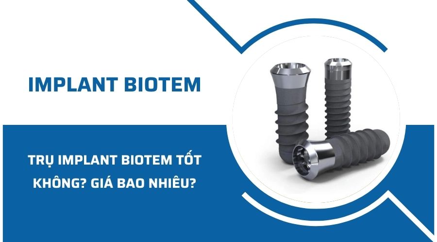 Trụ Implant Biotem có tốt không? Giá bao nhiêu?