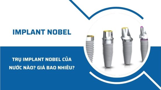 Trụ Implant Nobel của nước nào? Giá trụ bao nhiêu?