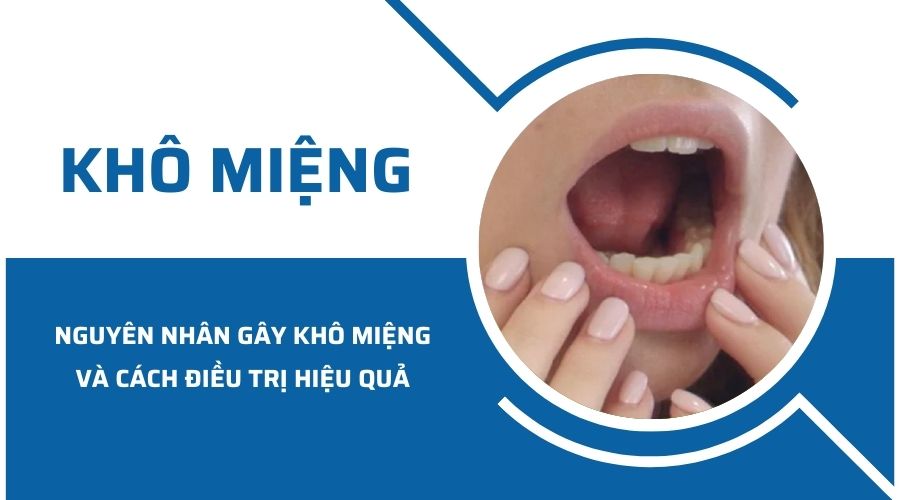 Nguyên nhân gây khô miệng và cách điều trị hiệu quả