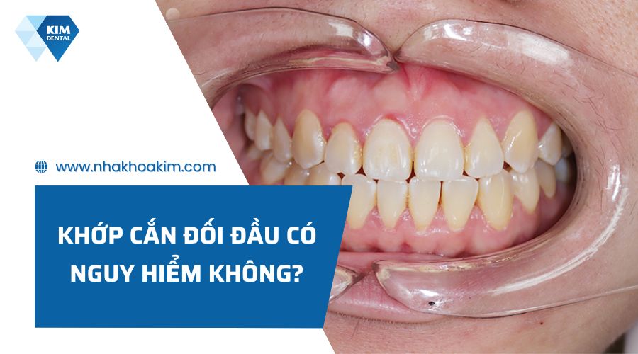 Khớp cắn đối đầu có nguy hiểm không?