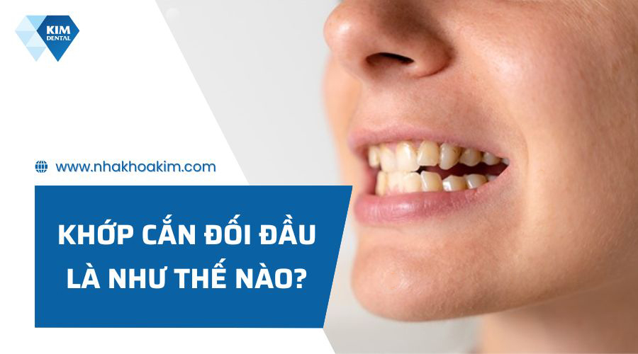 Khớp cắn đối đầu là như thế nào?