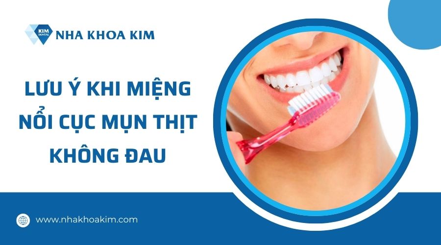 Lưu ý khi miệng nổi cục mụn thịt không đau