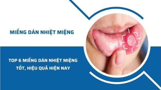 Top 6 miếng dán nhiệt miệng tốt, hiệu quả hiện nay