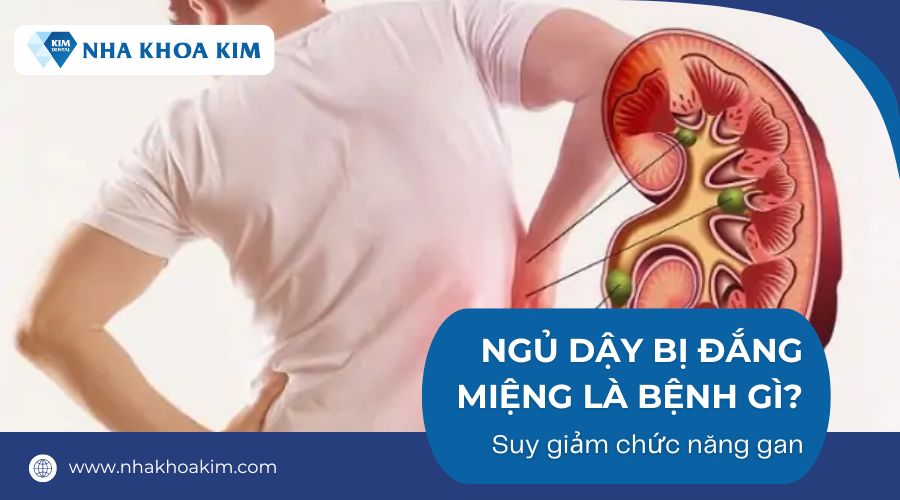 Ngủ Dậy Miệng Đắng Là Bệnh Gì? Nguyên Nhân và Cách Khắc Phục Hiệu Quả