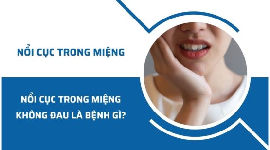 Nổi cục mụn thịt trong miệng không đau là bệnh gì?