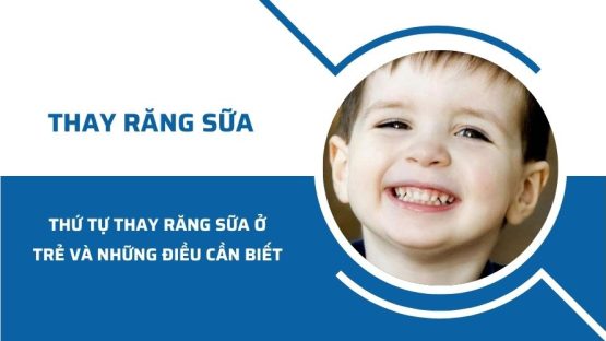 Thứ tự thay răng sữa ở trẻ và những điều cần biết