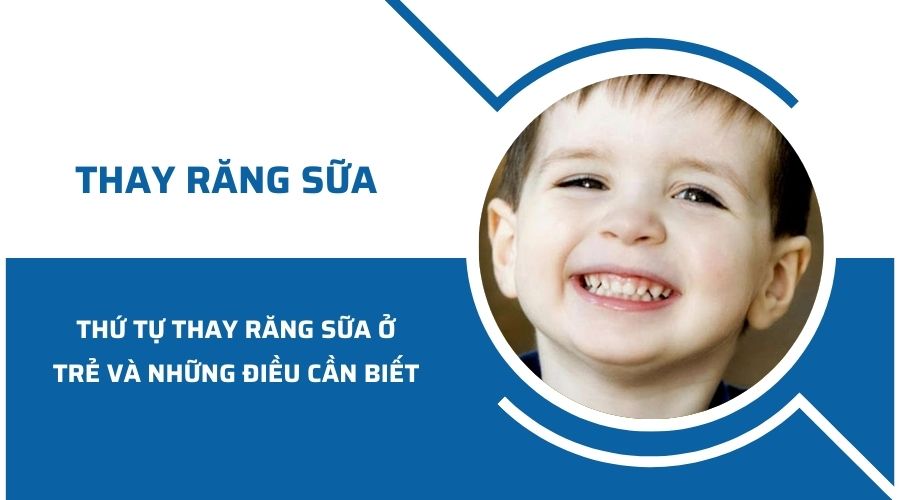 Thứ tự thay răng sữa ở trẻ và những điều cần biết