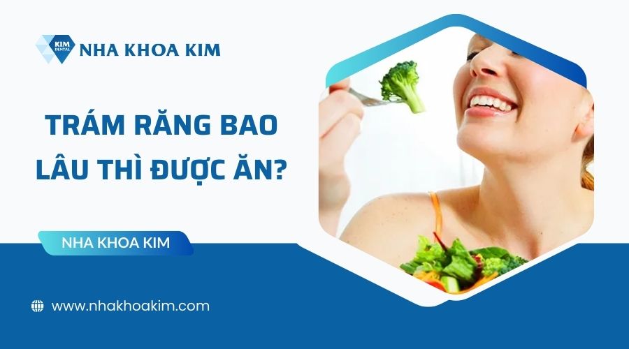 Trám răng bao lâu thì được ăn?