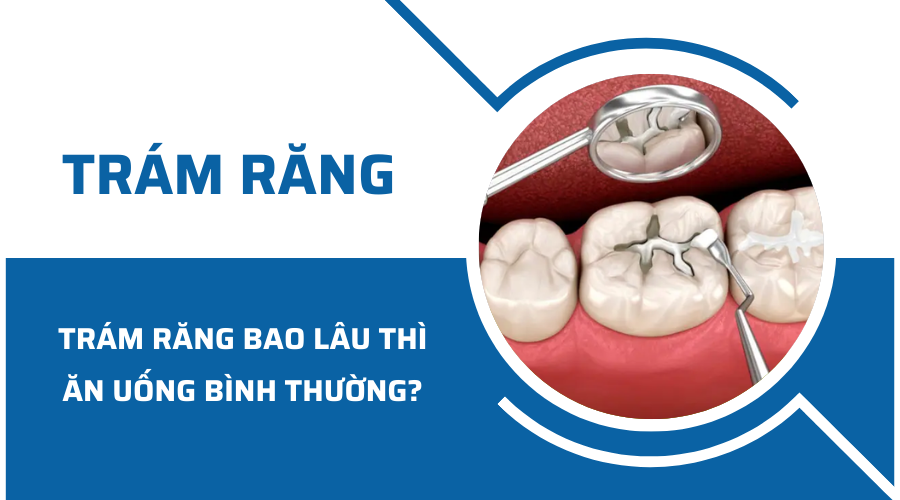 Trám răng bao lâu thì được ăn uống bình thường?