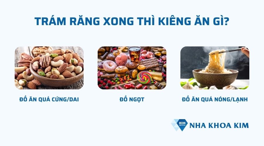 Trám răng xong thì kiêng ăn gì?