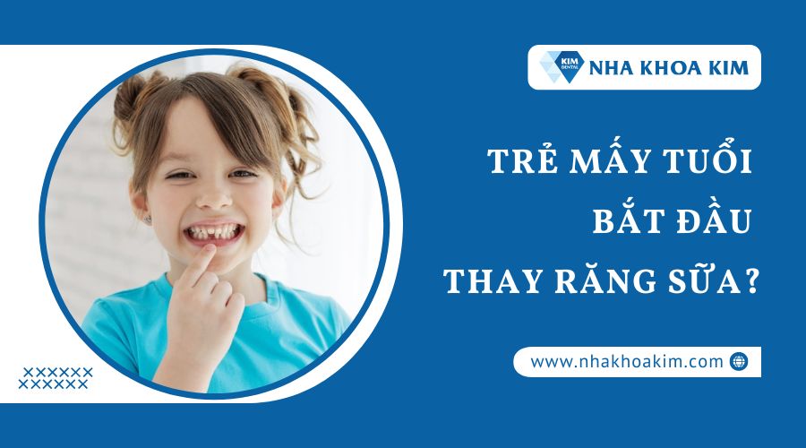 Trẻ mấy tuổi bắt đầu thay răng sữa?