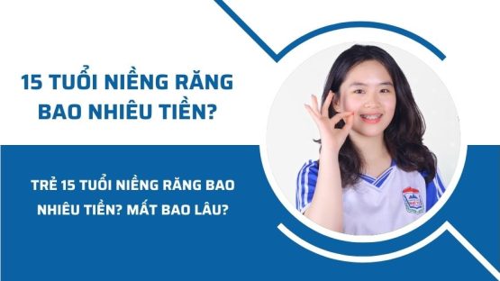 Trẻ 15 tuổi niềng răng bao nhiêu tiền? Mất bao lâu?