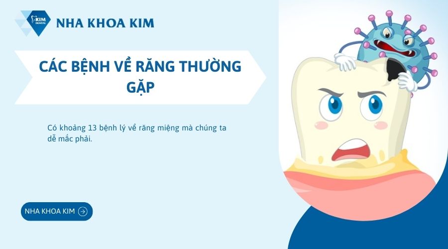 Các bệnh về răng thường gặp