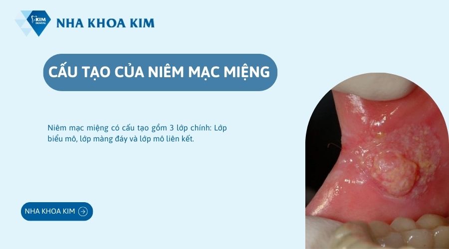 Cấu tạo của niêm mạc miệng