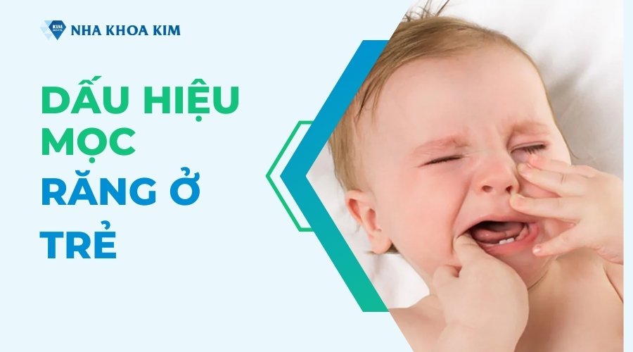 Các dấu hiệu mọc răng ở trẻ