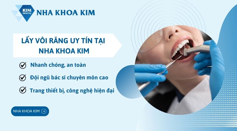 Nha Khoa Kim - Địa chỉ lấy vôi răng uy tín