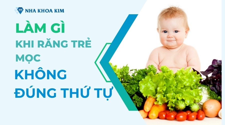 Làm gì khi răng trẻ mọc không đúng thứ tự?