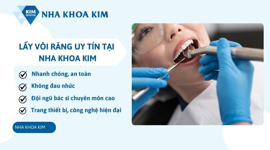Nha Khoa Kim - Địa chỉ lấy vôi răng uy tín