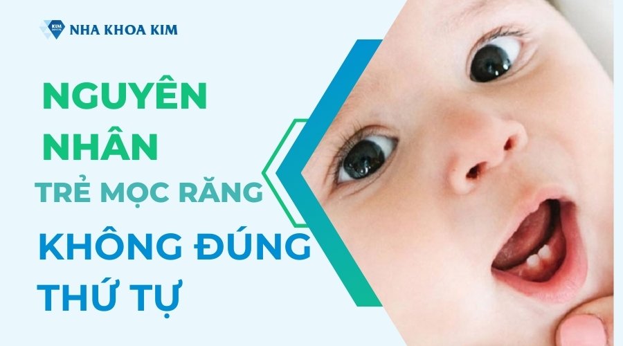 Nguyên nhân trẻ mọc răng không đúng thứ tự