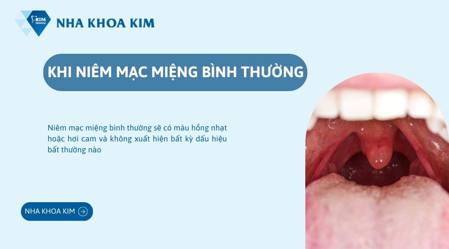 Niêm mạc miệng bình thường